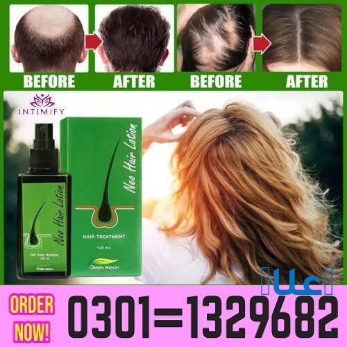 Neo Hair Lotion in Pakistan  [ 0301=1329682 ]